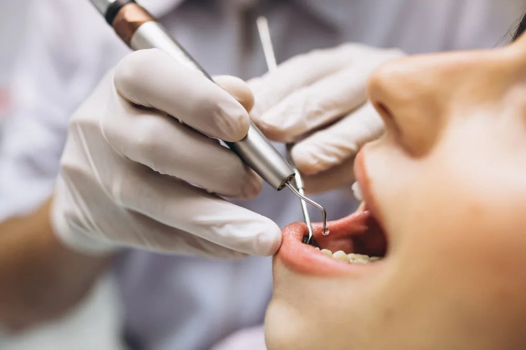 Estética Dental