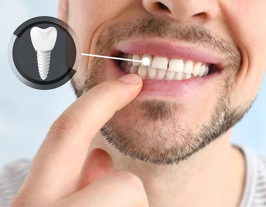 Prótesis dentales AKDENT